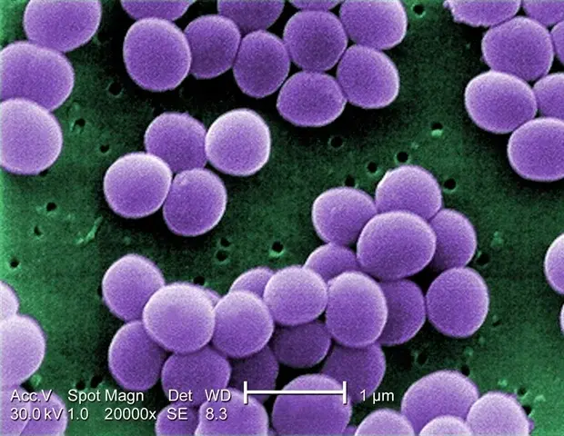 Bacterii rezistente găsite în aerul unei clinici din Africa de Sud