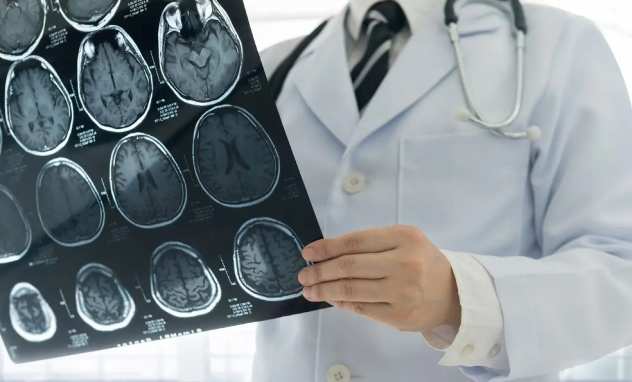 Doar 30% dintre pacienții cu AVC primesc recuperare neurologică