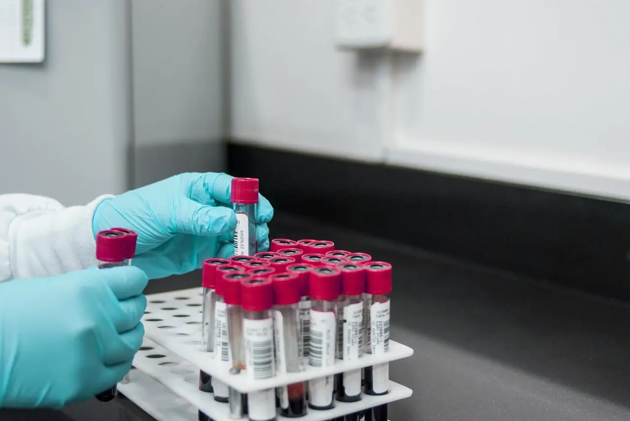 Un test de sânge urmărește evoluția cancerului pulmonar