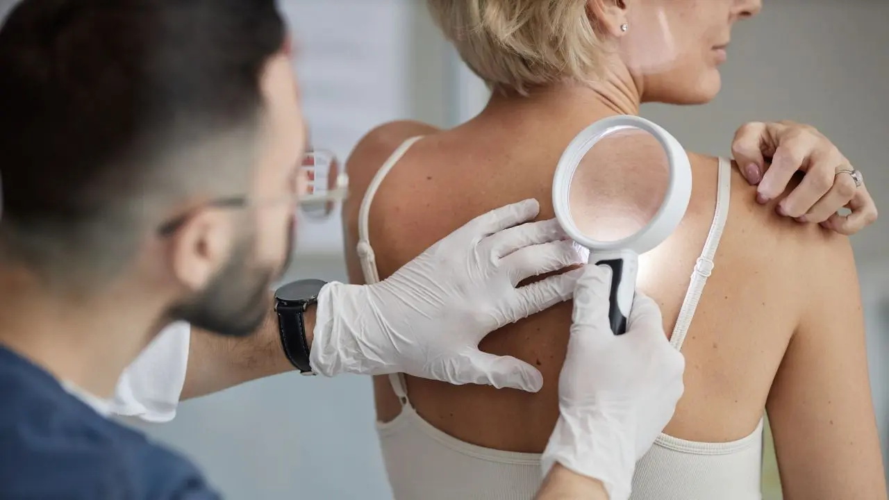 Vaccin personalizat reduce cu 42% riscul de deces în melanom